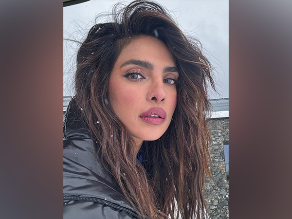 Priyanka Chopra shares look at injury from set of 'The Feign'